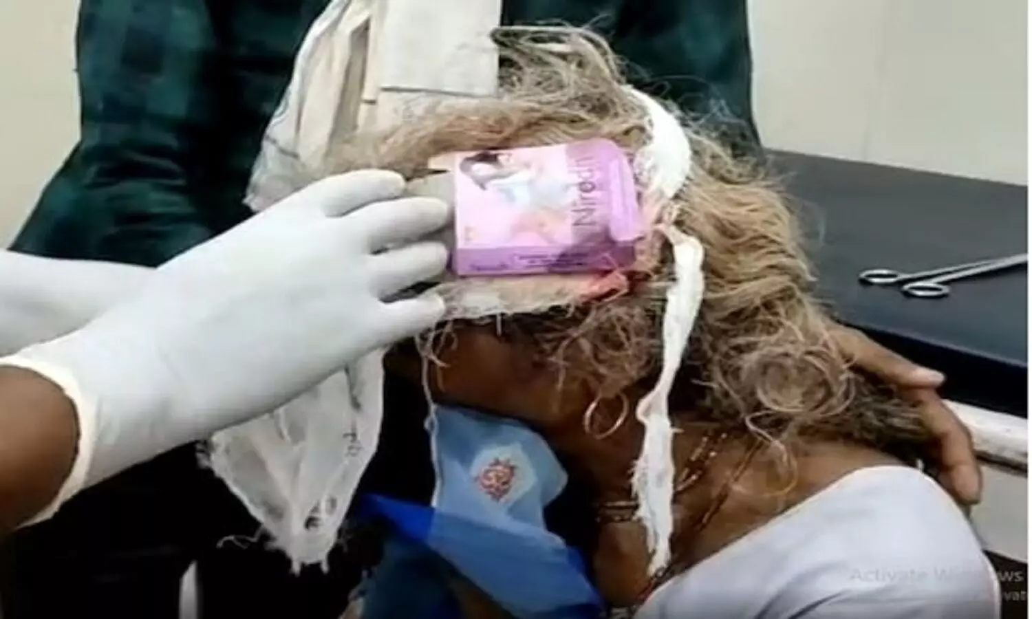 MP News: मुरैना में महिला के सिर में चोट लगी तो कंडोम का पैकेट लगाकर ड्रेसिंग कर दी
