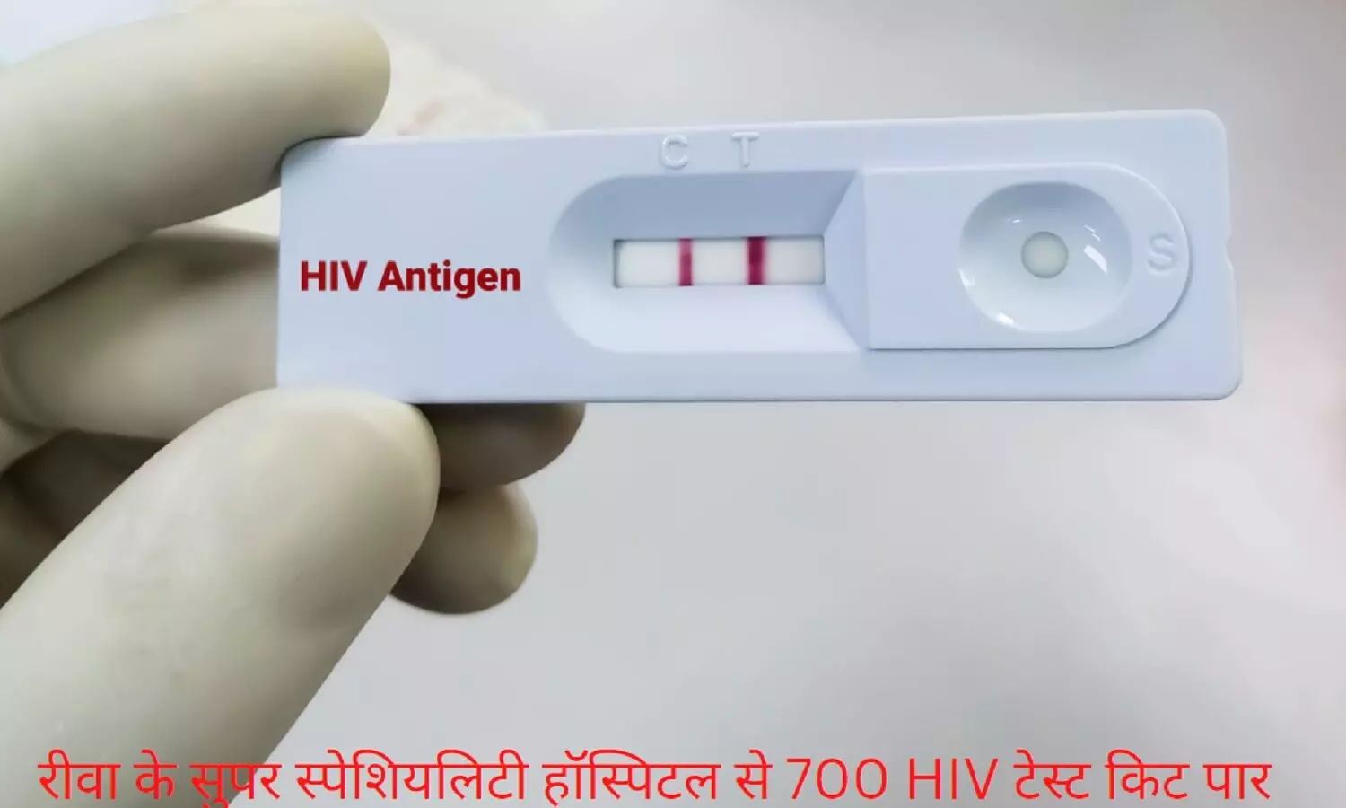 रीवा में सुपर स्पेशिएलिटी अस्पताल से 700 एचआईव्ही टेस्ट किट पार, जांच टीम गठित