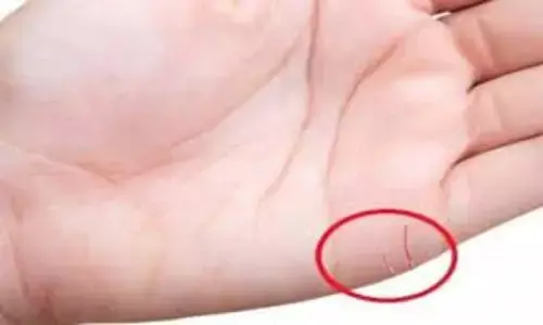 Palmistry: हथेली की रेखाएं दो शादी एवं अमीर घर में विवाह का देती है संकेत, जितनी ज्यादा रेखाएं-उतने ज्यादा अफेयर