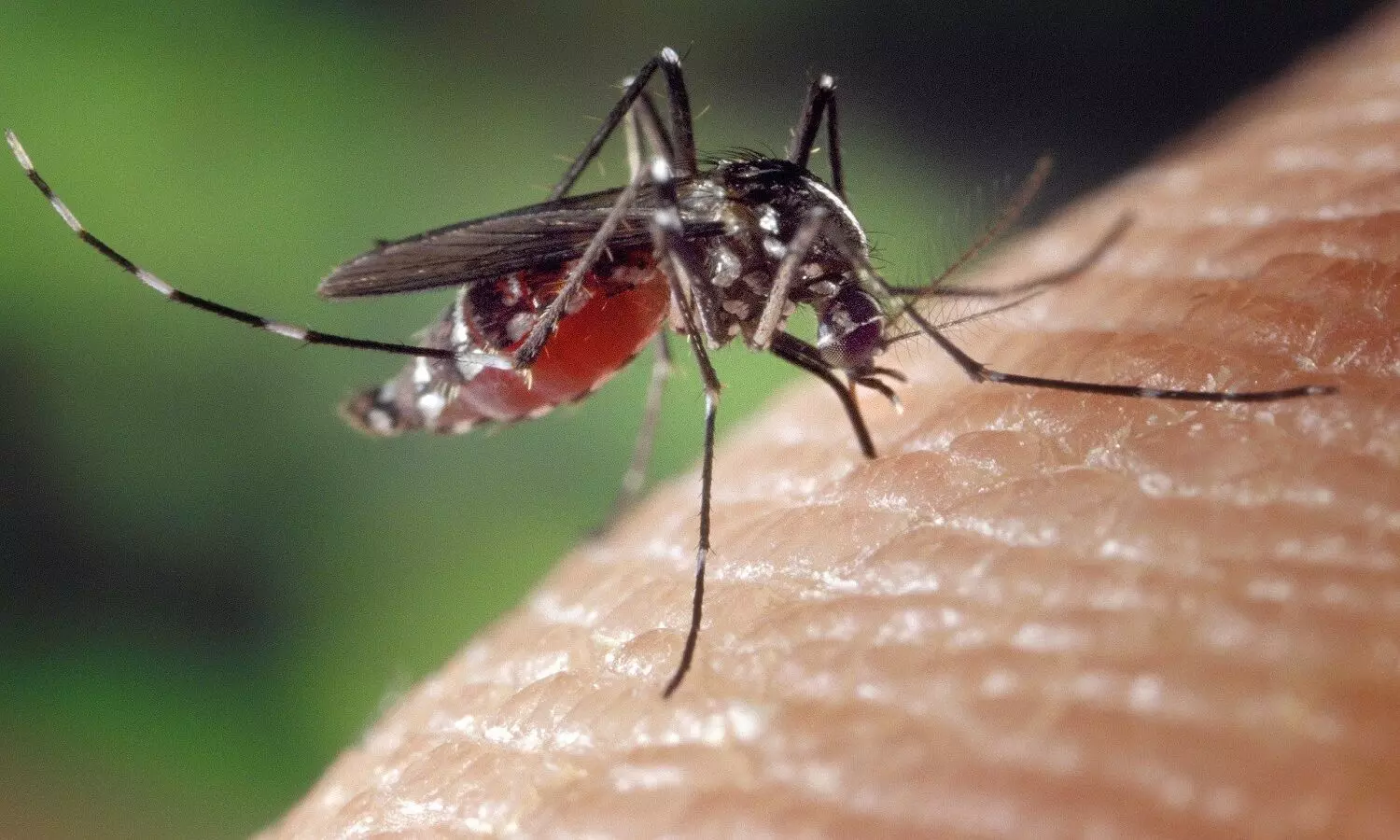 Mosquito Bites: इन कारणों से मच्छर आपको ही चुनते हैं काटने के लिए, जानें