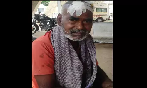 रीवा में बदमाश बेखौफ: छोटी सी बात में कर दी अधेड़ की पिटाई रीवा में बदमाश बेखौफ: छोटी सी बात में कर दी अधेड़ की पिटाई