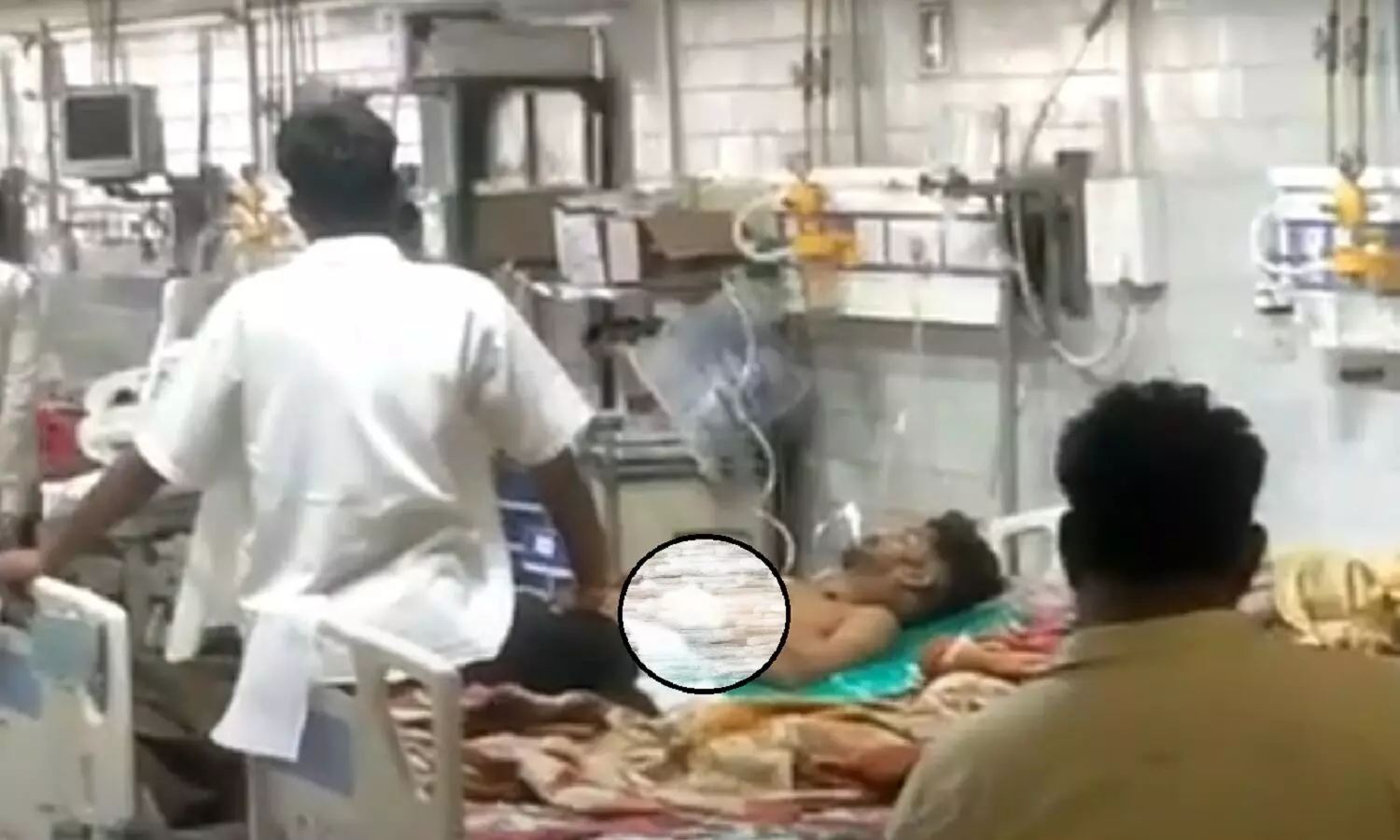 एमपी के सतना में होटल में चली गोली, दो युवक घायल