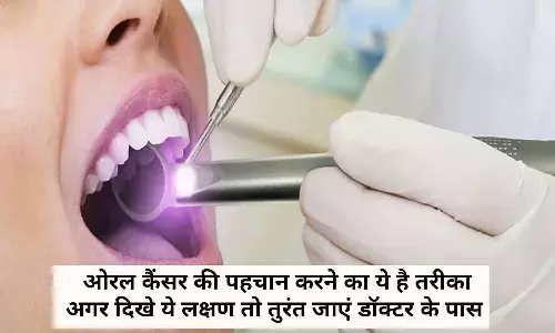 Symptoms Of Oral Cancer