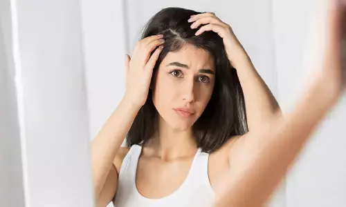 Dandruff Treatment : मात्र 10 रूपए में दूर हो जायेगा डैंड्रफ, खुद ही करें होम ट्रीटमेंट