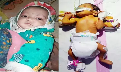 एमपी के इंदौर में कलेक्टर की पहल पर बच्ची का हुआ ऑपरेशन, मिला नया जीवन एमपी के इंदौर में कलेक्टर की पहल पर बच्ची का हुआ ऑपरेशन, मिला नया जीवन