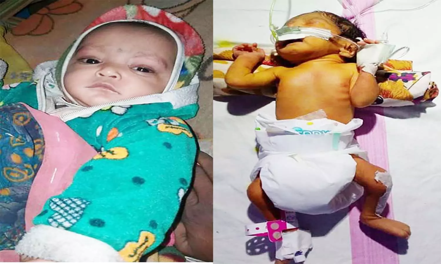 एमपी के इंदौर में कलेक्टर की पहल पर बच्ची का हुआ ऑपरेशन, मिला नया जीवन एमपी के इंदौर में कलेक्टर की पहल पर बच्ची का हुआ ऑपरेशन, मिला नया जीवन