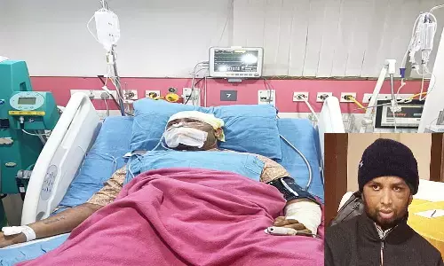 एमपी के खंडवा में हजारों की संख्या में मधुमक्खियों ने किया हमला, चिकित्सकों ने तीन दिन निकाले डंक