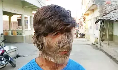 एमपी के रतलाम में आकर्षण का केन्द्र बना मानव का विचित्र स्वरूप