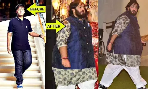 दुबला होने के बाद फिर मोटे हो गए Anant Ambani! इस बड़ी बीमारी का हुए शिकार