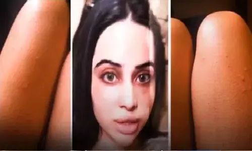 उर्फी जावेद इस बीमारी के कारण नहीं पहनती पूरे कपड़े!