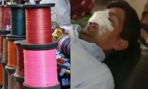 मध्य प्रदेश: उज्जैन में चाइनीज मांझे से बीजेपी नेता की नाक कट गई! मध्य प्रदेश: उज्जैन में चाइनीज मांझे से बीजेपी नेता की नाक कट गई!