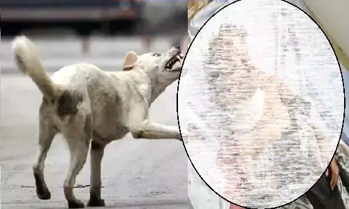 MP: सिंगरौली में आवारा कुत्तों ने 5 साल के मासूम को नोच खाया! MP: सिंगरौली में आवारा कुत्तों ने 5 साल के मासूम को नोच खाया!