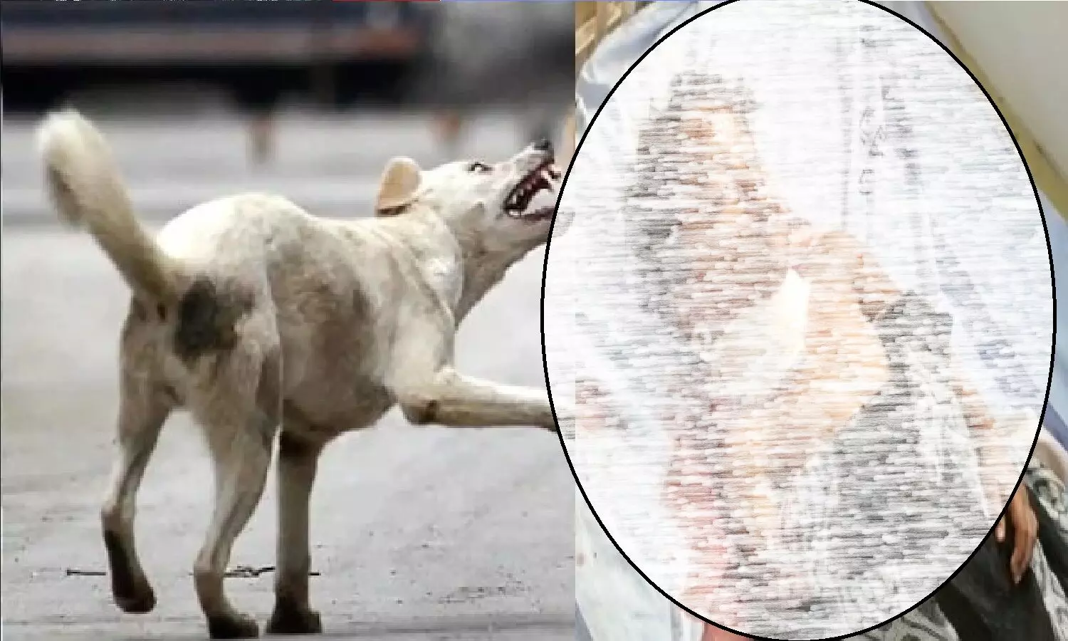 MP: सिंगरौली में आवारा कुत्तों ने 5 साल के मासूम को नोच खाया! MP: सिंगरौली में आवारा कुत्तों ने 5 साल के मासूम को नोच खाया!