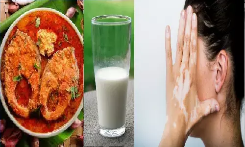 क्या मछली खाने के बाद दूध पीने से शरीर में सफ़ेद दाग बन जाते हैं?
