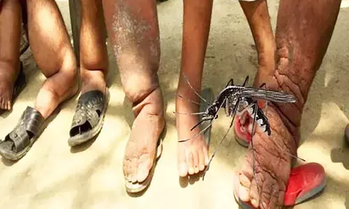 एमपी के 12 जिलों में मंडरा रहा क्यूलेक्स मच्छर का खतरा, लोगों को बना सकते हैं दिव्यांग एमपी के 12 जिलों में मंडरा रहा क्यूलेक्स मच्छर का खतरा, लोगों को बना सकते हैं दिव्यांग