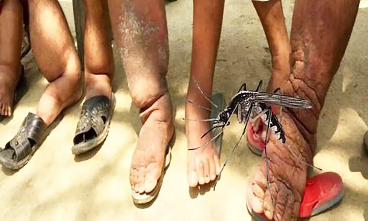 एमपी के 12 जिलों में मंडरा रहा क्यूलेक्स मच्छर का खतरा, लोगों को बना सकते हैं दिव्यांग एमपी के 12 जिलों में मंडरा रहा क्यूलेक्स मच्छर का खतरा, लोगों को बना सकते हैं दिव्यांग