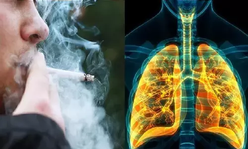 सिगरेट पीने की आदत है और फेफड़ों को लेकर चिंता भी है? इन तरीकों से लंग्स को डिटॉक्स कर सकते हैं