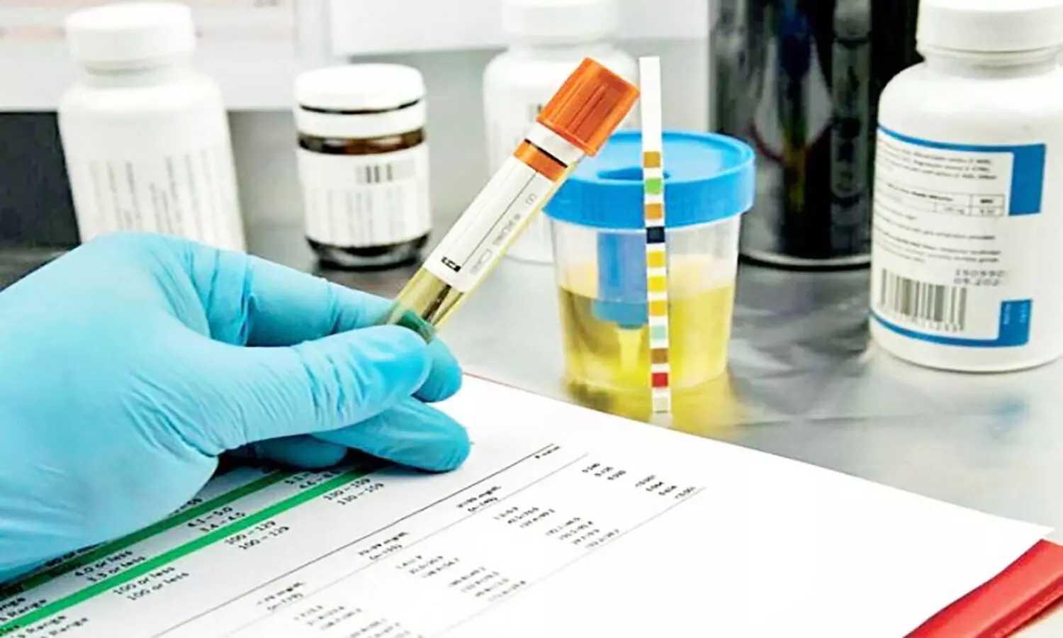 Forensic Science Lab: मेथ, एलएसडी व म्याऊं-म्याऊं जैसे ड्रग्स की अब एमपी में हो सकेगी जांच Forensic Science Lab: मेथ, एलएसडी व म्याऊं-म्याऊं जैसे ड्रग्स की अब एमपी में हो सकेगी जांच