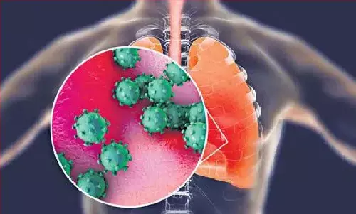 Influenza A Virus Subtype H3N2 से देश में पहली बार मौत! कर्नाटक-हरियाणा के दो मरीजों की मौत, कोरोना की तरह फ़ैल रहा संक्रमण