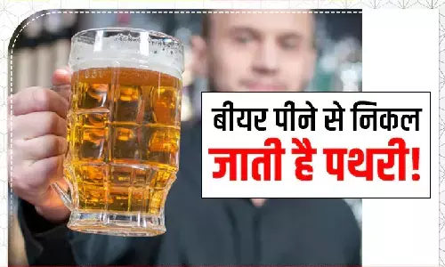क्या बीयर पीने से पथरी निकल जाती है? जानें सच्चाई