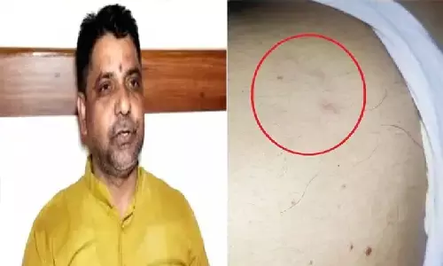 ज्ञानवापी के पैरोकार जितेंद्र सिंह विसेन पर इंजेक्शन से हमला! वायरस से जान लेने की कोशिश