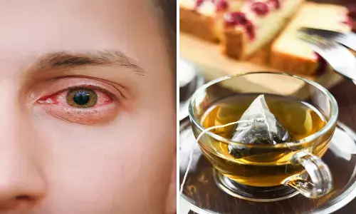 Eye Flu Home Remedies: आई फ्लू से लाल हो रही आंखों को जलन, चुभन और दर्द से तुरंत मिलेगा आराम, आजमाएं यह घरेलू नुस्खे Eye Flu Home Remedies: आई फ्लू से लाल हो रही आंखों को जलन, चुभन और दर्द से तुरंत मिलेगा आराम, आजमाएं यह घरेलू नुस्खे