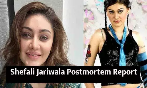Shefali Jariwala Postmortem Report: शेफाली जरीवाला की पोस्टमॉर्टम रिपोर्ट को लेकर BIG UPDATE? जाने पूरी डिटेल्स...