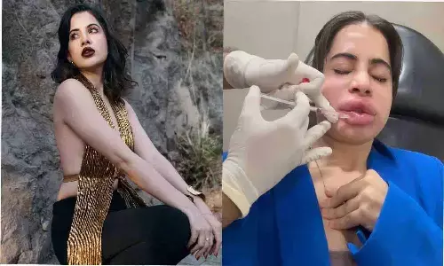 उर्फी जावेद ने हटवाया Lip Filler, फैंस बोले- Natural Is Beautiful