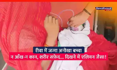 रीवा में एलियन जैसा दिखने वाला नवजात चर्चा में: शरीर सफ़ेद, बिना आँख-कान के जन्मा; हालत नाजुक