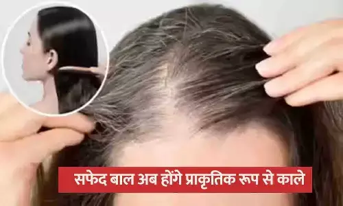 सफेद बाल अब होंगे प्राकृतिक रूप से काले
