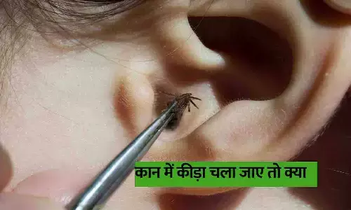 कान में कीड़ा चला जाए तो क्या करें? जानें लक्षण, घरेलू उपाय और कब जाएं डॉक्टर के पास