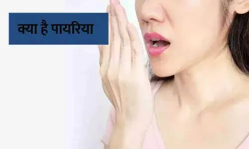 पायरिया