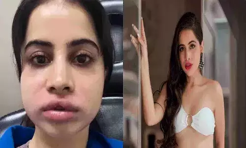 Urfi Javed Ko Kya Hua Hai? किया था आत्महत्या का प्रयास...जाने पूरी वजह...