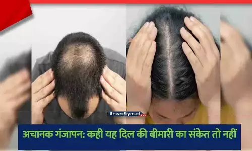 अचानक गंजापन और हार्ट अटैक का रिश्ता