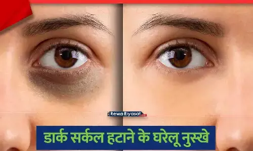 Home Remedies for Dark Circles Gulab Jal Aloe Vera Milk