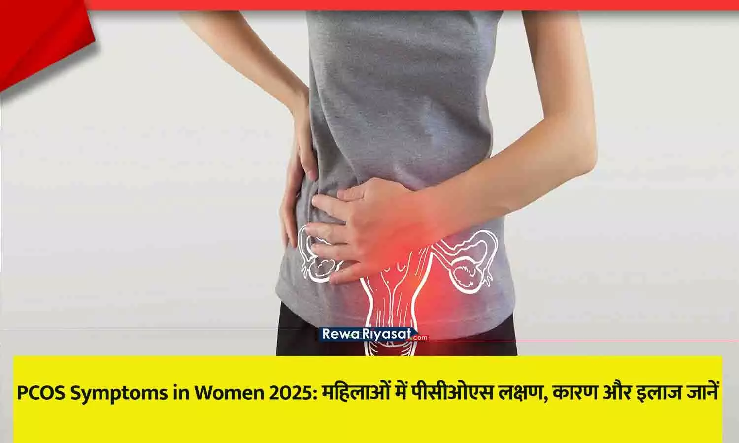 पीसीओएस (PCOS) के लक्षण: चेहरे पर मुंहासे, अनचाहे बाल और सिर के बालों का झड़ना पीसीओएस (PCOS) के लक्षण: चेहरे पर मुंहासे, अनचाहे बाल और सिर के बालों का झड़ना