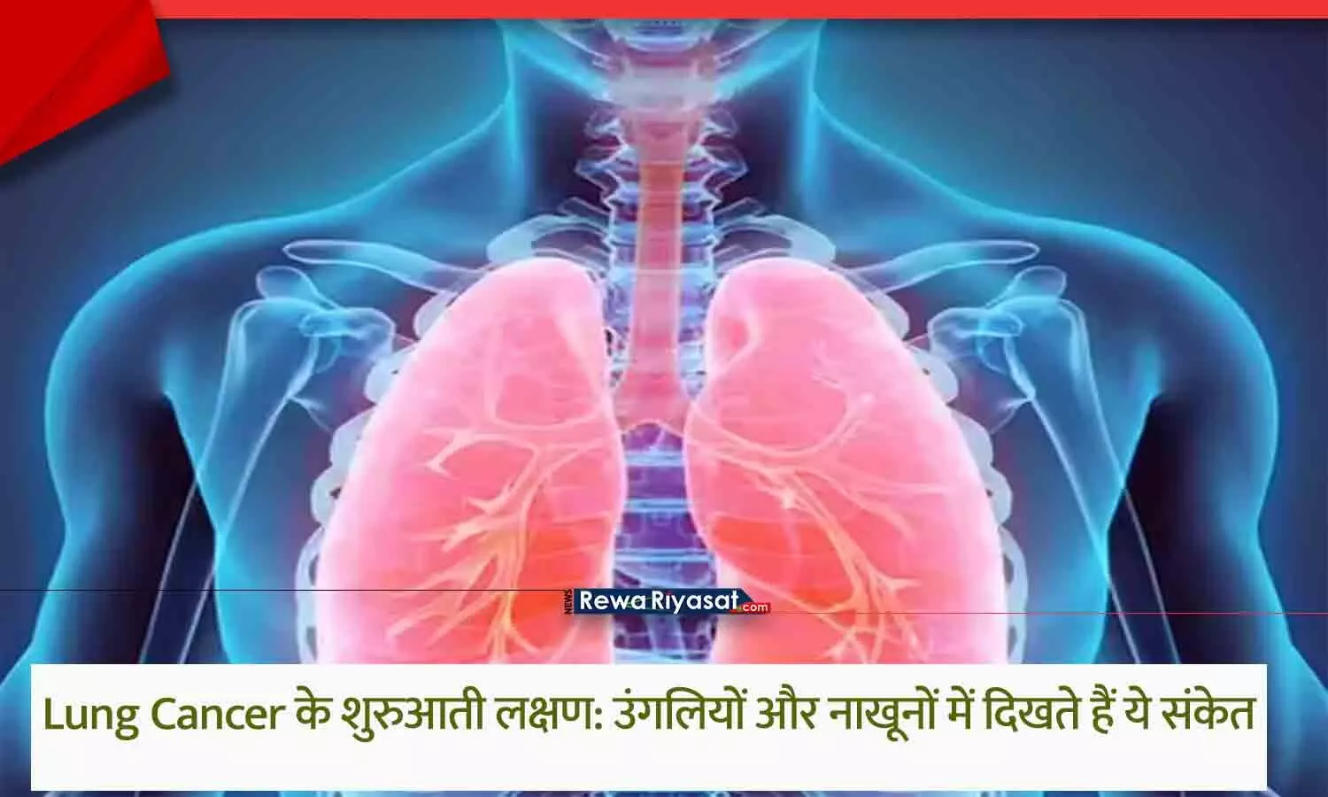 Early Signs of Lung Cancer in Nails and Fingers 2025 Early Signs of Lung Cancer in Nails and Fingers 2025