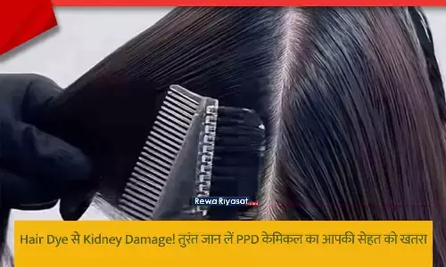 Hair Dye Se Kidney Damage Risk Hair Dye Se Kidney Damage Risk