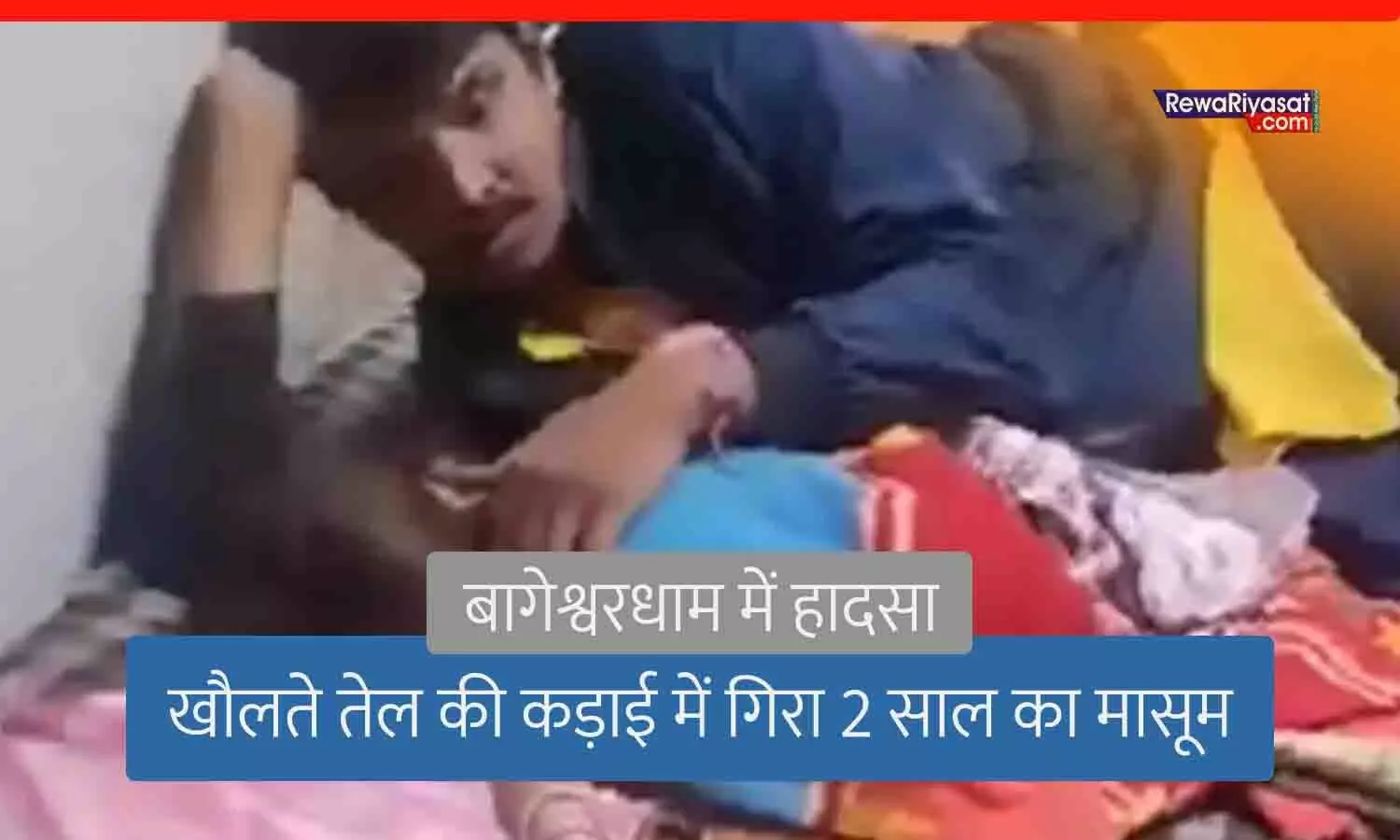 बागेश्वर धाम में हादसा: 2 साल का बच्चा समोसे बन रहे गर्म तेल की कढ़ाई में गिरा, दादी के हाथ भी झुलसे