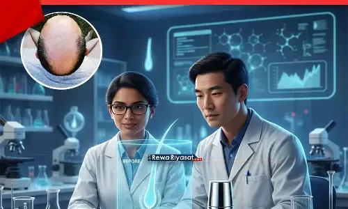 अब सिर्फ 20 दिन में झड़ें बाल वापस आएंगे | Regrow hair in 20 days अब सिर्फ 20 दिन में झड़ें बाल वापस आएंगे | Regrow hair in 20 days