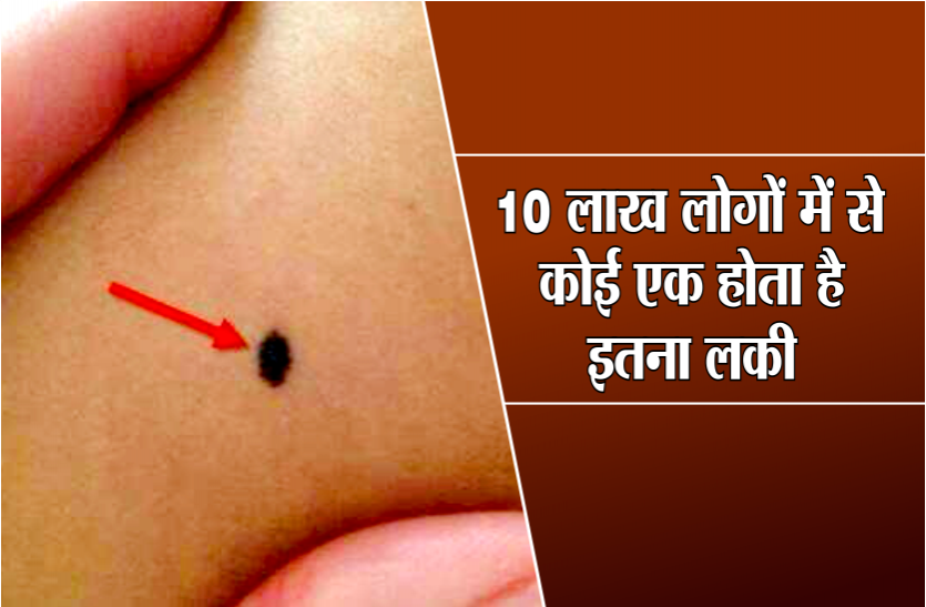 10 लाख लोगों में से कोई एक होता है इतना भाग्यशाली, जिसके इस खास स्थान पर होता है तिल