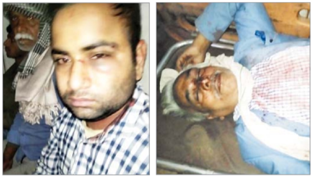 पुलिस के सामने हमलावरों ने दिया वारदात को अंजाम, घंटो चला खूनी संघर्ष : REWA NEWS