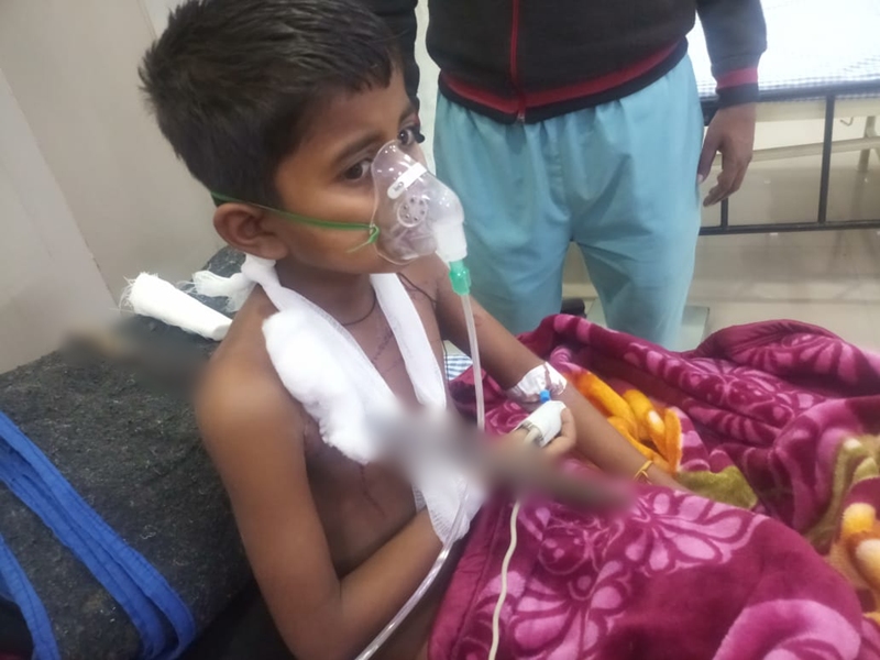 8 साल के बच्चे के सीने को पार कर निकल गई थी राड, 2 घंटे के ऑपरेशन के बाद अाई चौंका देने वाली खबर..Rewa News