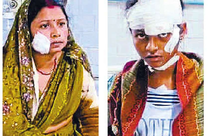 रीवा: घर की छत पर खड़े होकर बारात देखना पड़ा मंहगा, अचानक आकर लगी गोली, महिला एवं किशोरी घायल रीवा: घर की छत पर खड़े होकर बारात देखना पड़ा मंहगा, अचानक आकर लगी गोली, महिला एवं किशोरी घायल