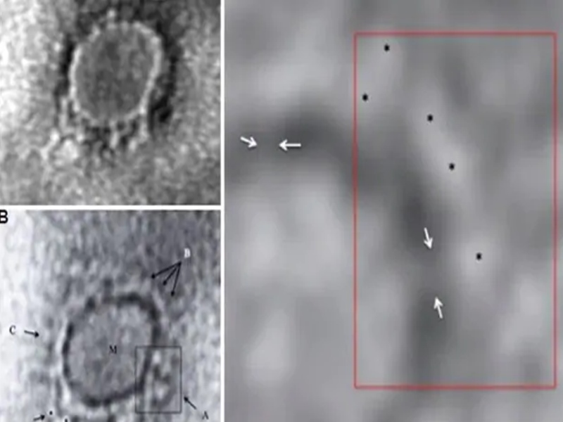 देश में कुल मामले 918 हुए, तेलंगाना में पहली मौत देश में कुल मामले 918 हुए, तेलंगाना में पहली मौत