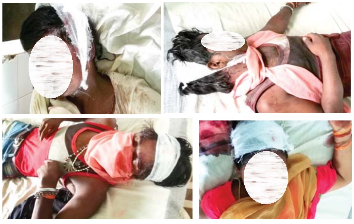 रीवा में 100 रूपए के लिए दर्जन भर लोगों के बीच खूनी संघर्ष, दो की मौत रीवा में 100 रूपए के लिए दर्जन भर लोगों के बीच खूनी संघर्ष, दो की मौत