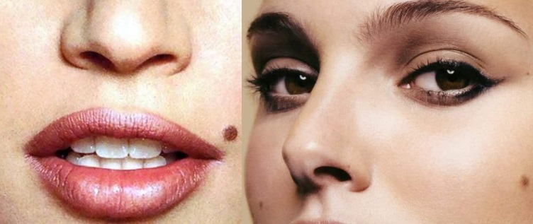 धनवान बनने का संकेत देता है चेहरे में मौजूद यह तिल, जानिए शरीर मौजूद तिलों के बारे में