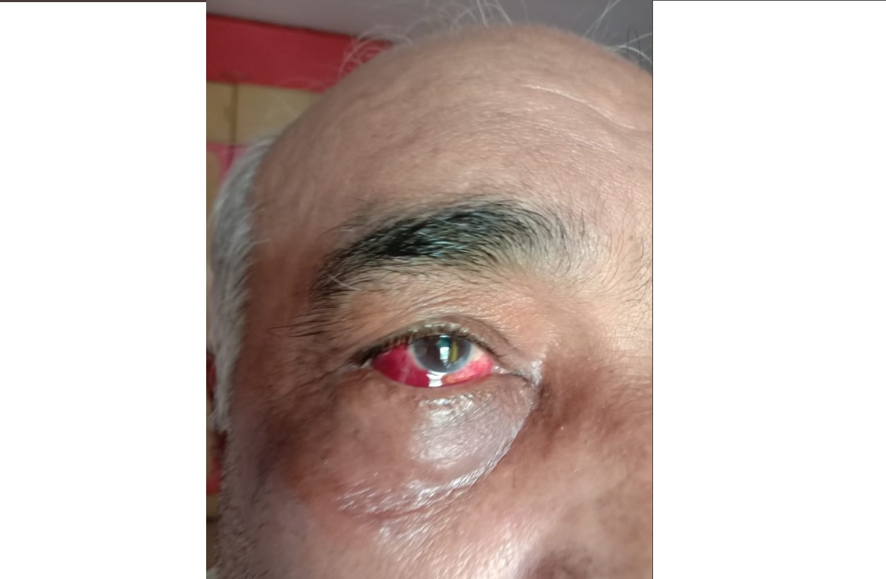 Video: मुंबई में शिवसैनिकों ने रिटायर्ड नेवी अफसर को बेरहमी से पीटा, गिरफ्तार होने के बाद जल्द ही मिल गई जमानत Video: मुंबई में शिवसैनिकों ने रिटायर्ड नेवी अफसर को बेरहमी से पीटा, गिरफ्तार होने के बाद जल्द ही मिल गई जमानत