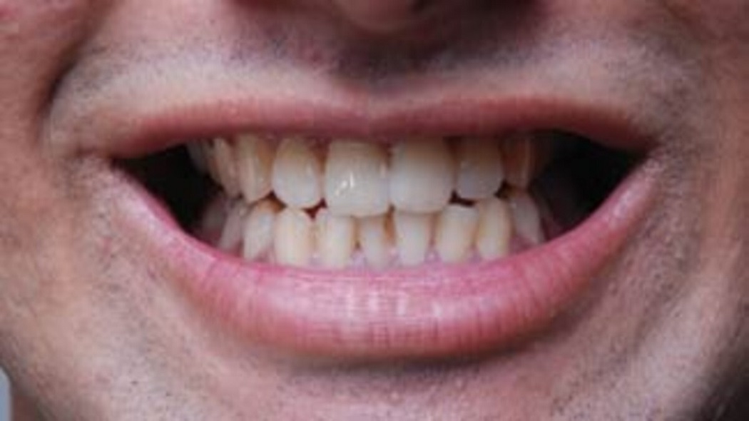 रीवा: गुंडों ने अपने दांत से युवक के कांट लिए नाक, जानिए क्या है विवाद रीवा: गुंडों ने अपने दांत से युवक के कांट लिए नाक, जानिए क्या है विवाद