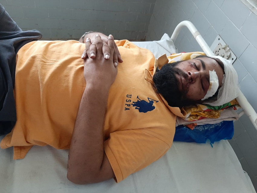 रीवा: नशे के सौदागरों ने किया युवक पर जानलेवा हमला, पढ़िए पूरी खबर रीवा: नशे के सौदागरों ने किया युवक पर जानलेवा हमला, पढ़िए पूरी खबर